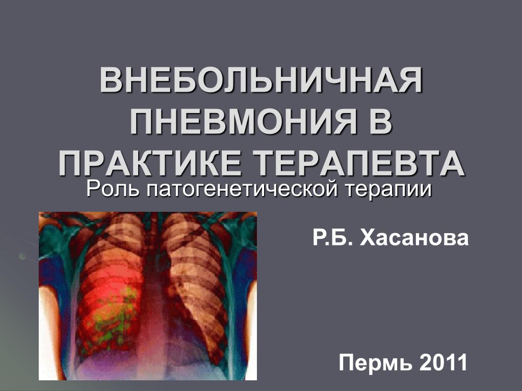 Пневмония клинический случай. Пневмония клинические рекомендации. Внебольничная пневмония клинические рекомендации. Внебольничная пневмония рекомендации. Внебольничная пневмония клинические рекомендации 2023.