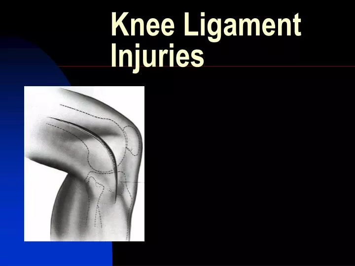 PPT - Knee Ligament Injuries PowerPoint Presentation, free download ...