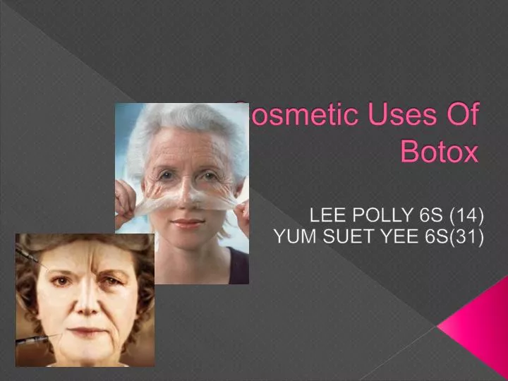 cosmetic uses of botox n.