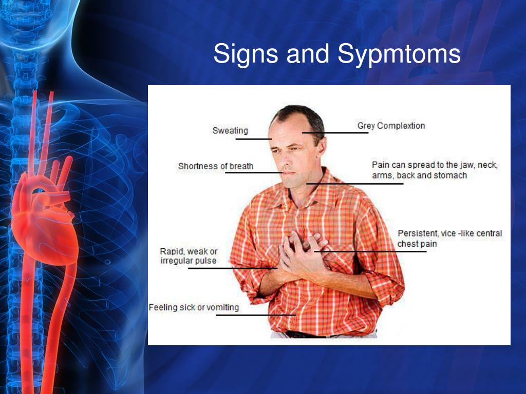 PPT - STEMI PowerPoint Presentation, free download - ID:1423479