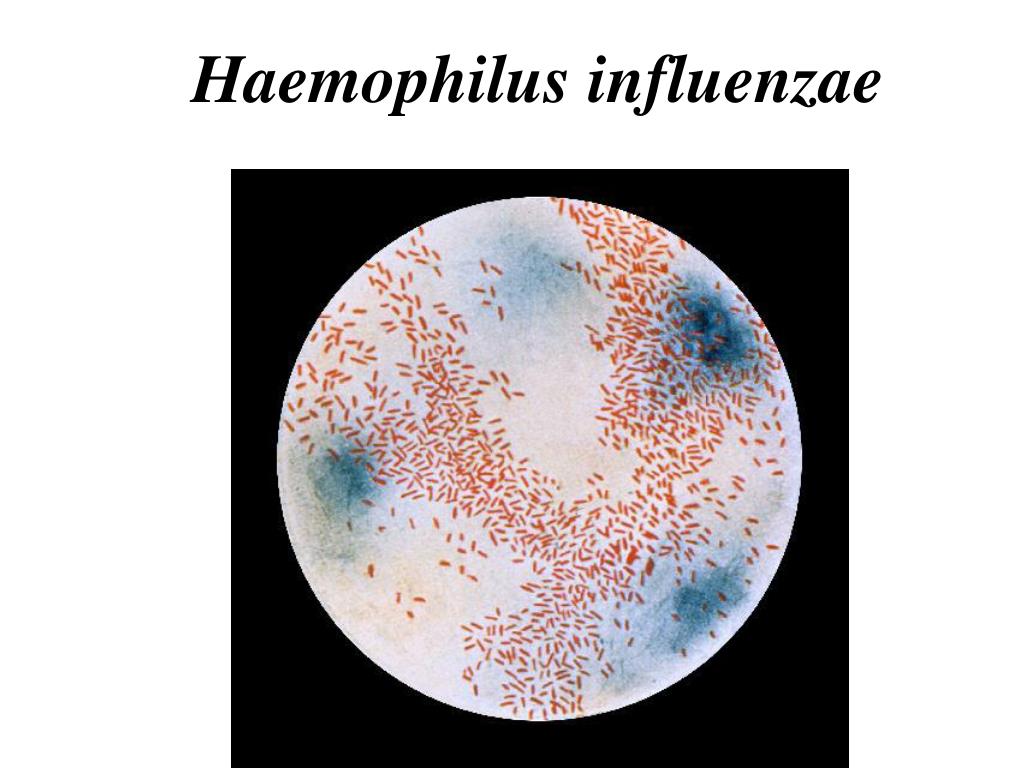 Haemophilus influenzae b. Гемофильная палочка микроскопия. Гемофильная палочка Афанасьева Пфейффера. Гемофильная палочка под микроскопом. Гемофильная инфлюэнца.