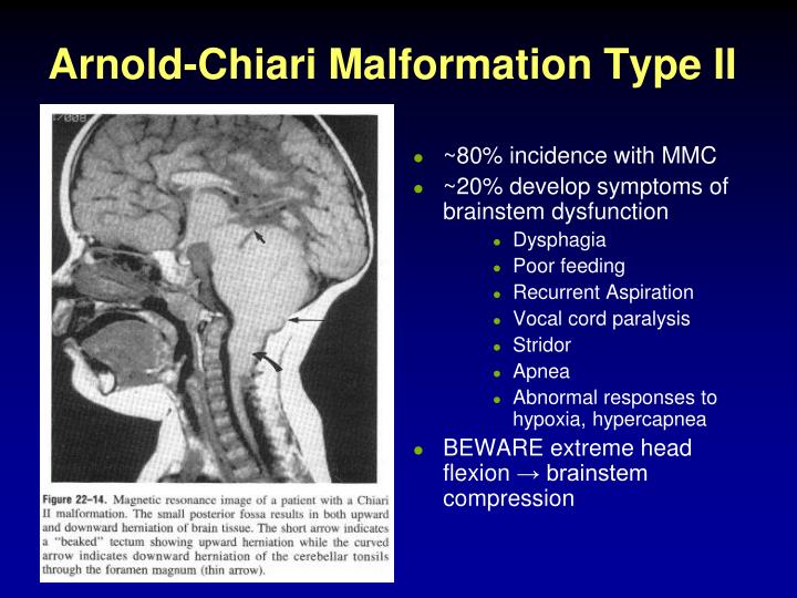 PPT Case Presentation Meningomyelocele PowerPoint Presentation ID — free download