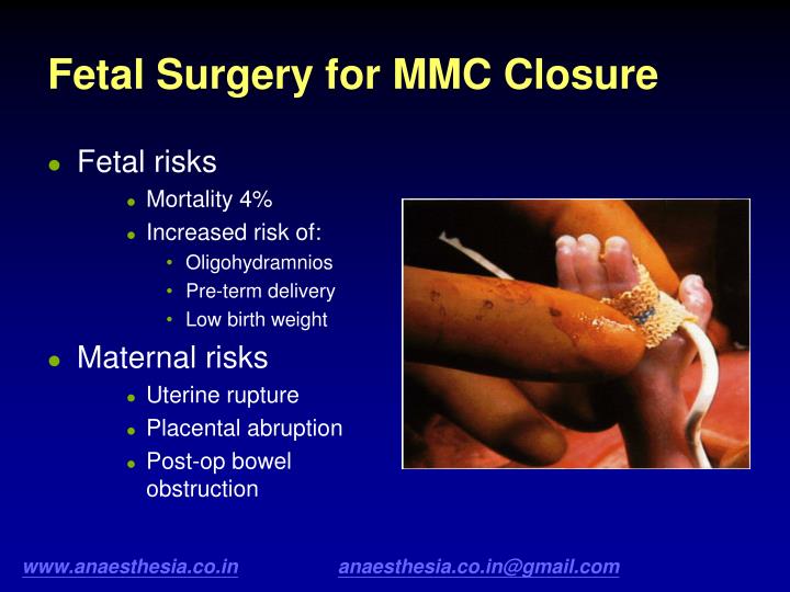 PPT - Case Presentation Meningomyelocele PowerPoint Presentation - ID ...