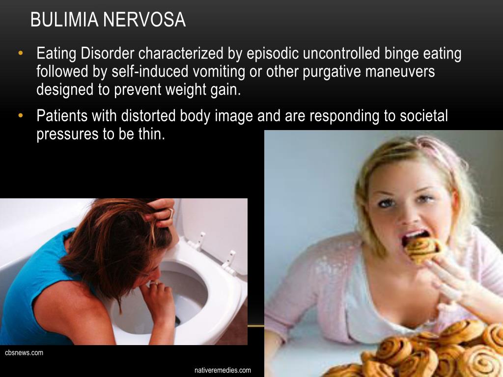 Bulimia nerviosa que es