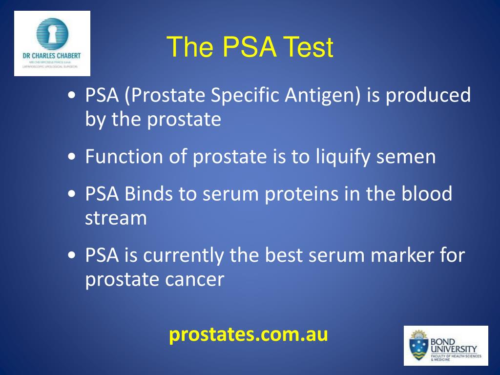 PPT - Prostate Cancer Screening PowerPoint Presentation, free download ...