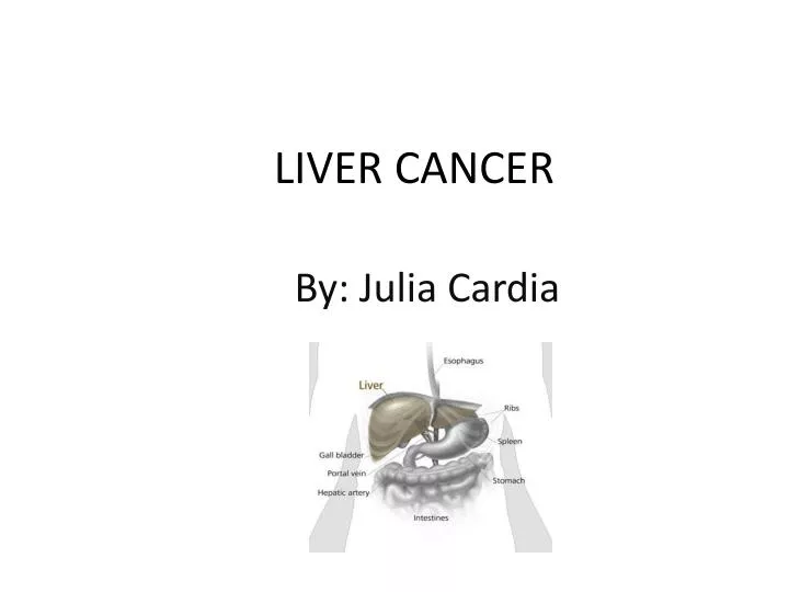 PPT LIVER CANCER PowerPoint Presentation, free download ID1431590