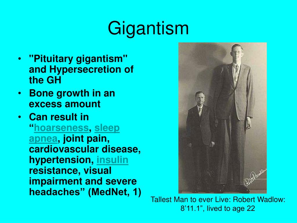 pituitary gigantism vs acromegaly