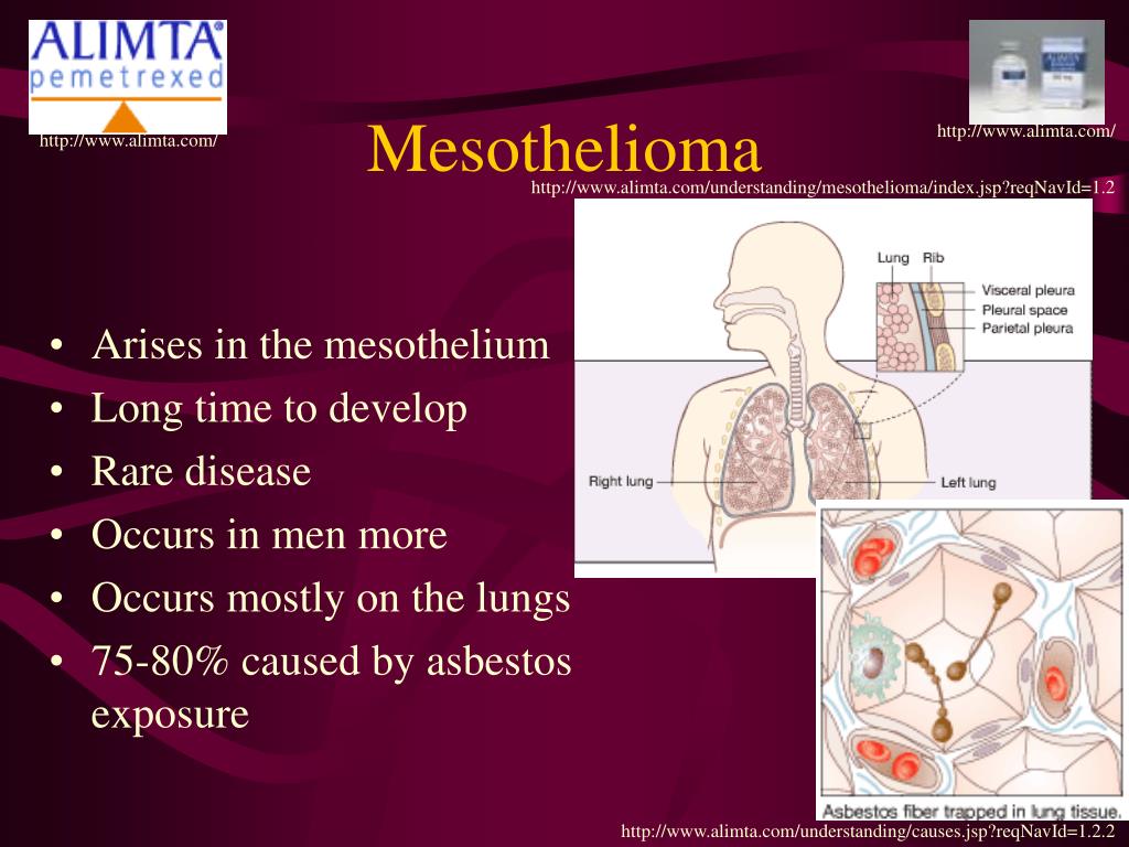 any cure for mesothelioma