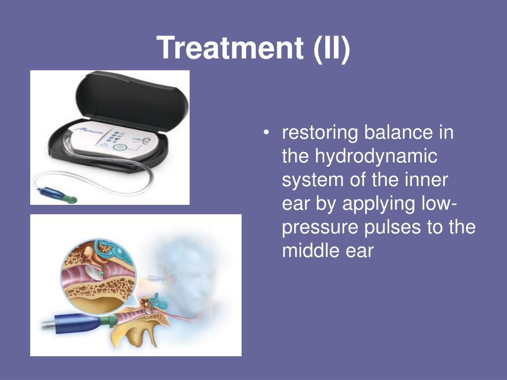 PPT - Meniere&#39;s Disease PowerPoint Presentation, free download - ID:1438164