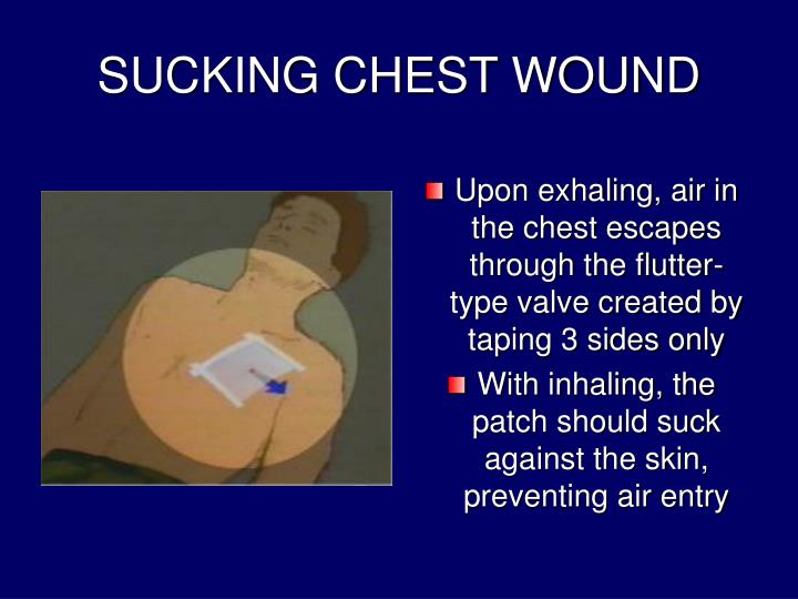 flutter in chest with cough flutter in chest with cough