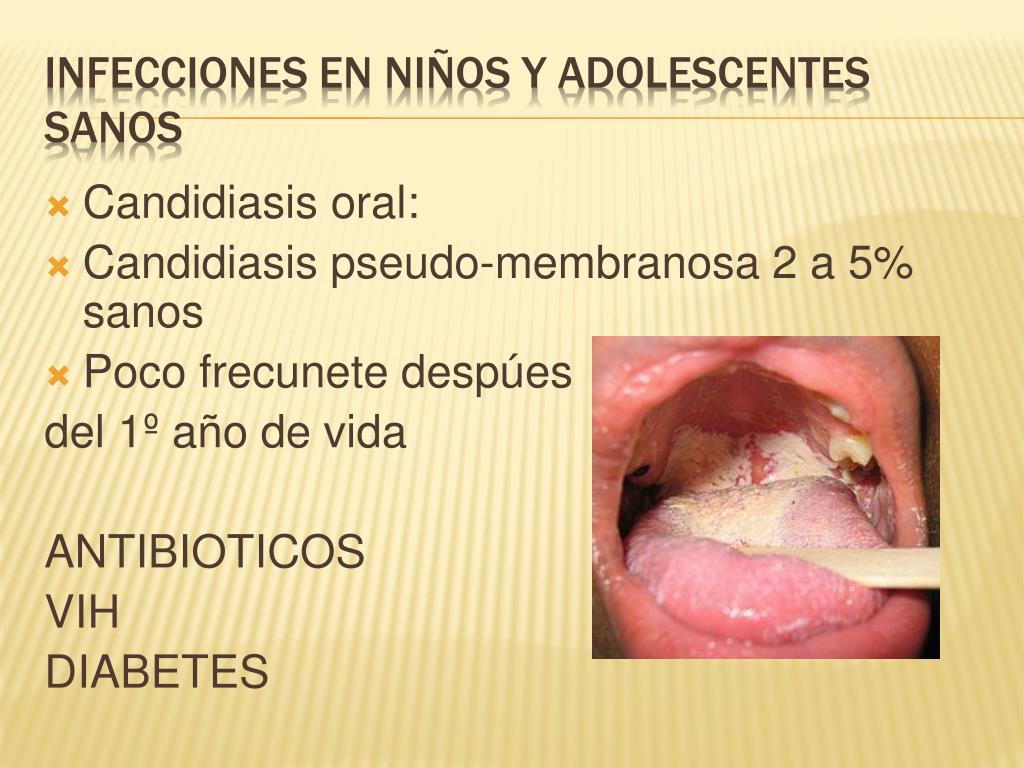 Que tomar para la candidiasis