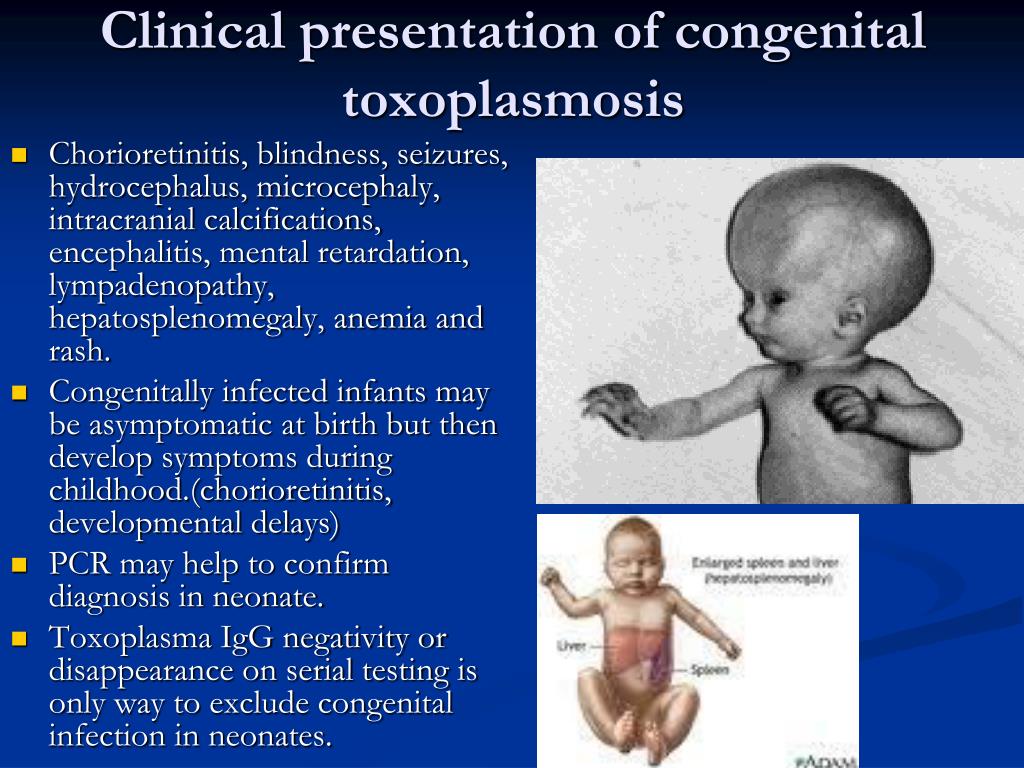 Congenital Toxoplasmosis Rash 9358
