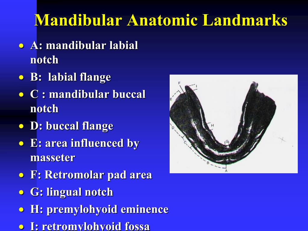 PPT - Anatomy of Mandibular Denture Bearing Area PowerPoint