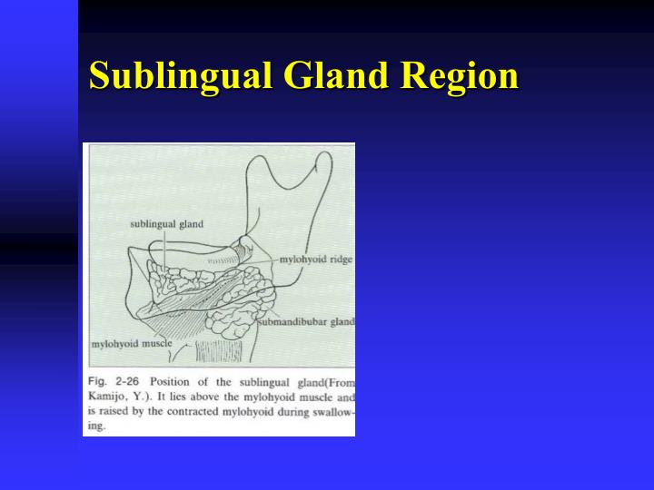 PPT - Anatomy of Mandibular Denture Bearing Area PowerPoint ...