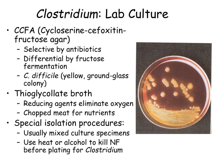 PPT - The Anaerobes PowerPoint Presentation - ID:1445854