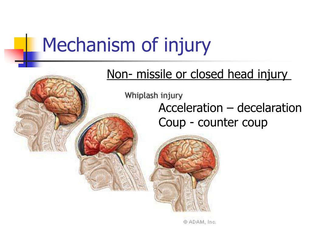 slide presentation on head injury