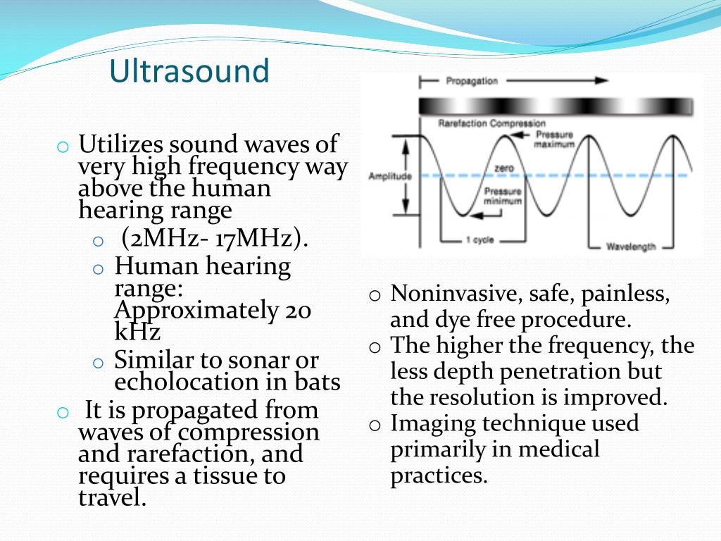 Ppt Ultrasound Powerpoint Presentation Free Download Id1451781