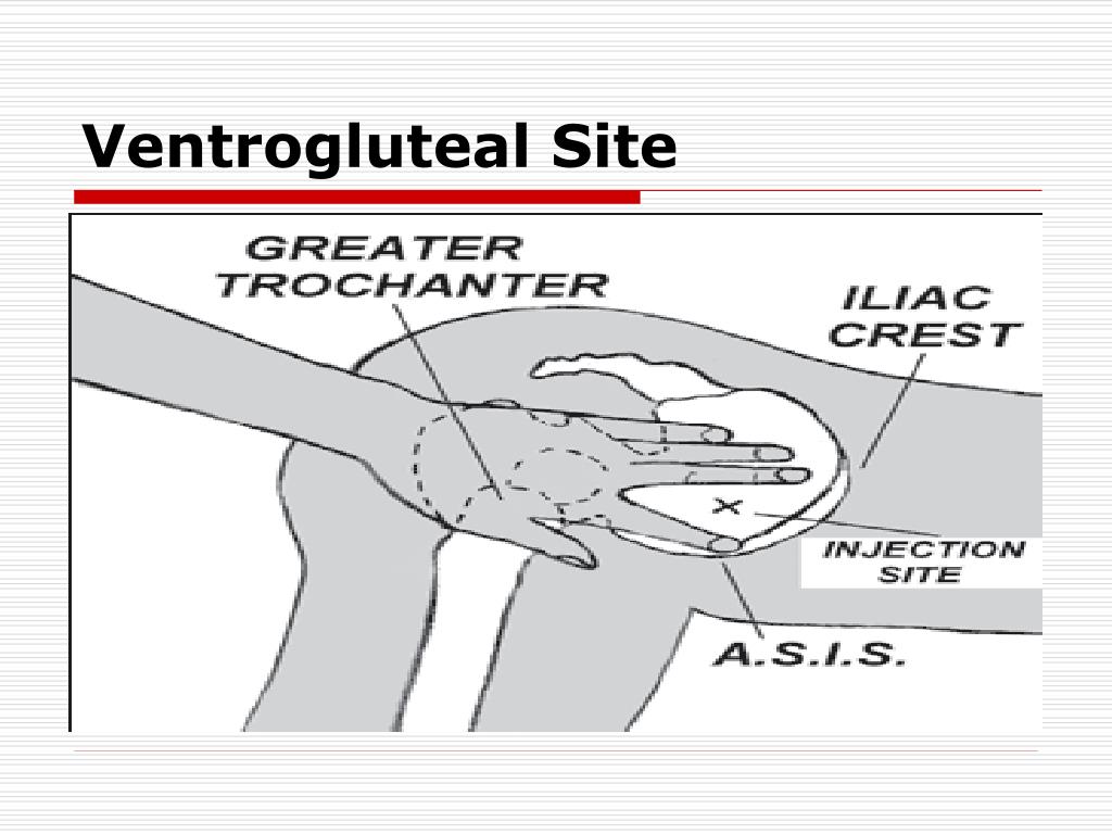 PPT Intramuscular Injection PowerPoint Presentation Free Download 