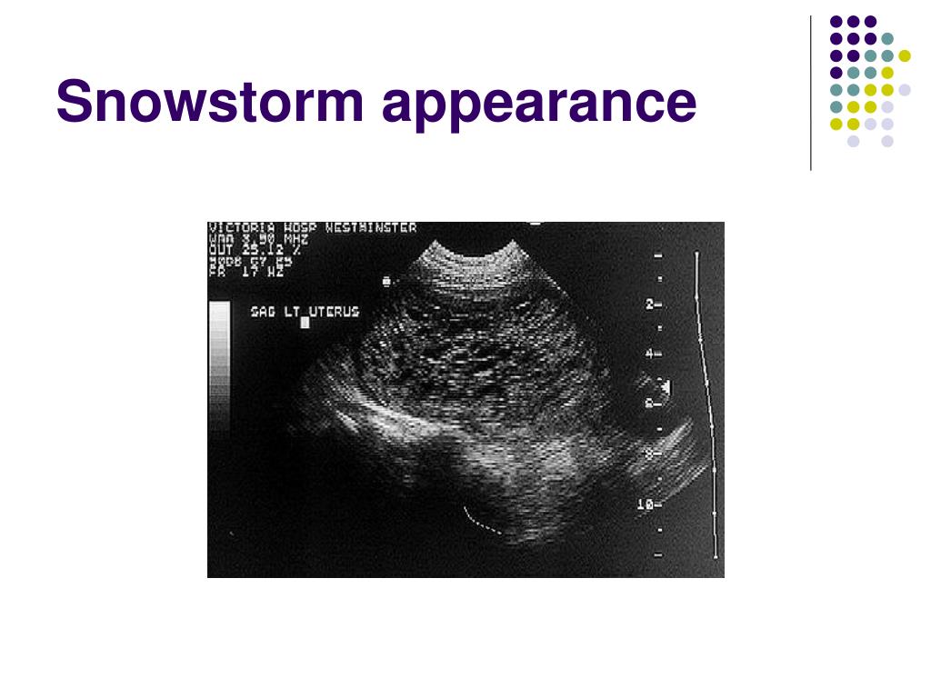 PPT Early Pregnancy Problems PowerPoint Presentation, free download