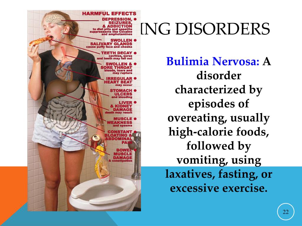 Bulimia Nervosa:A disorder characterized by episodes of overeating, usually...