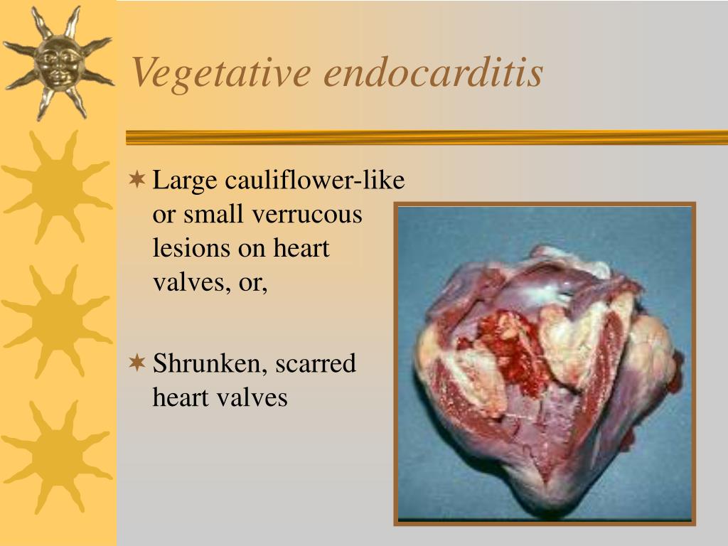 PPT Food Animal Cardiology PowerPoint Presentation Free Download ppt-food-animal-cardiology-powerpoint-presentation-free-download