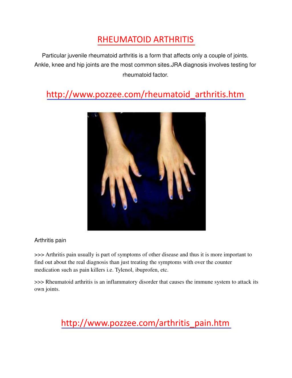 Rheumatoid Arthritis Ppt Indonesia