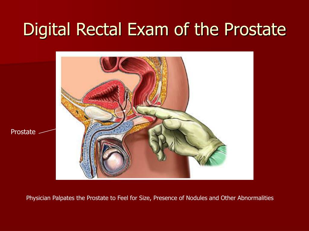 Ppt Transrectal Ultrasound And Prostate Biopsy Powerpoint Presentation Id
