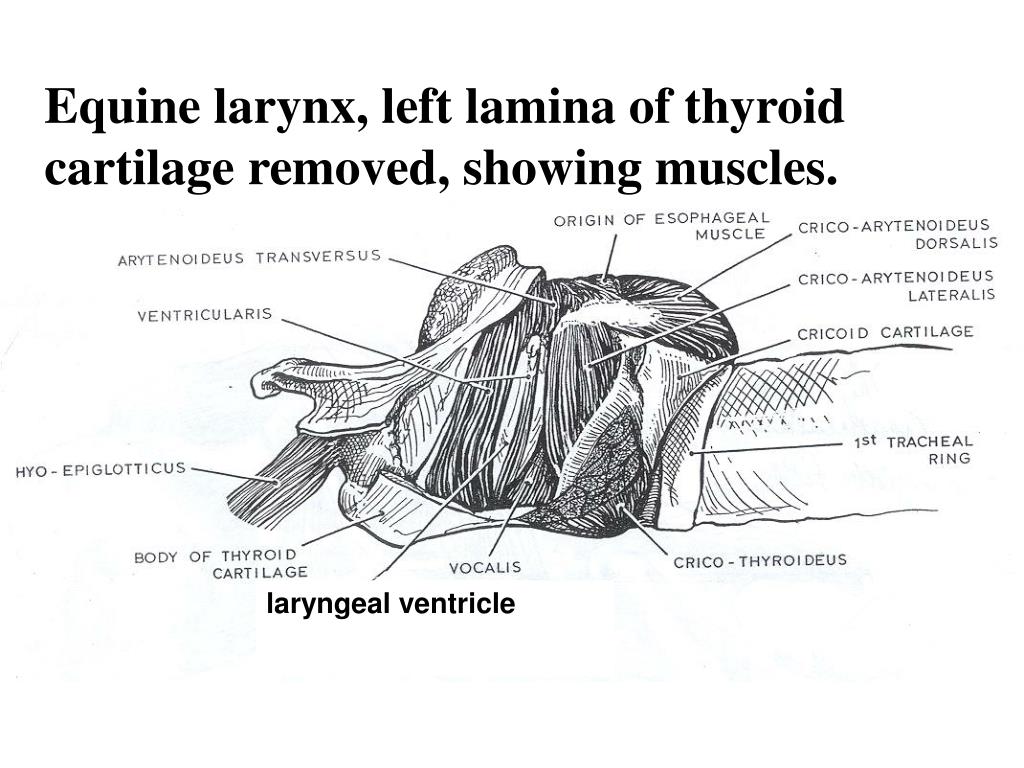 PPT - LARYNX POWERPOINT SERIES Prepared by Dr A Horowitz PowerPoint ...