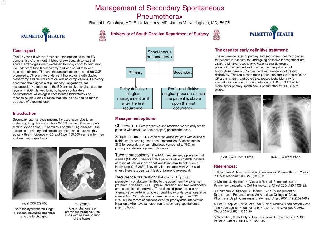 PPT Management of Secondary Spontaneous Pneumothorax PowerPoint