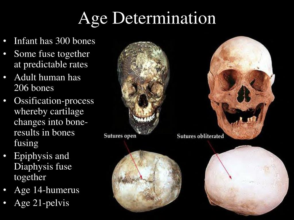 PPT - Identification of Human Remains PowerPoint Presentation, free
