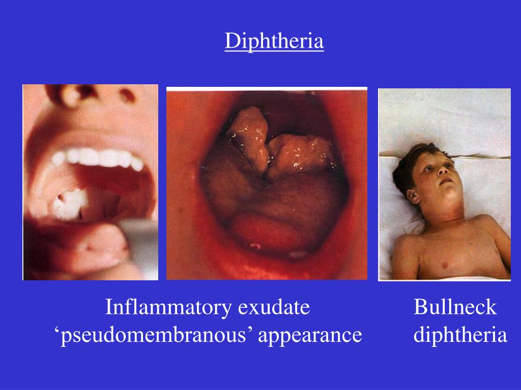 PPT SBM 2044 Lecture 8 Bacillus And Corynebacterium PowerPoint 