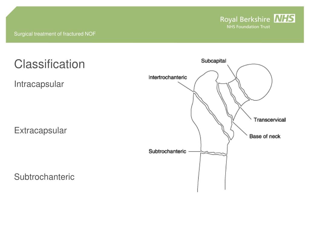 PPT Comprehensive Surgical Treatment Of Fractured Hip Neck Of Femur 