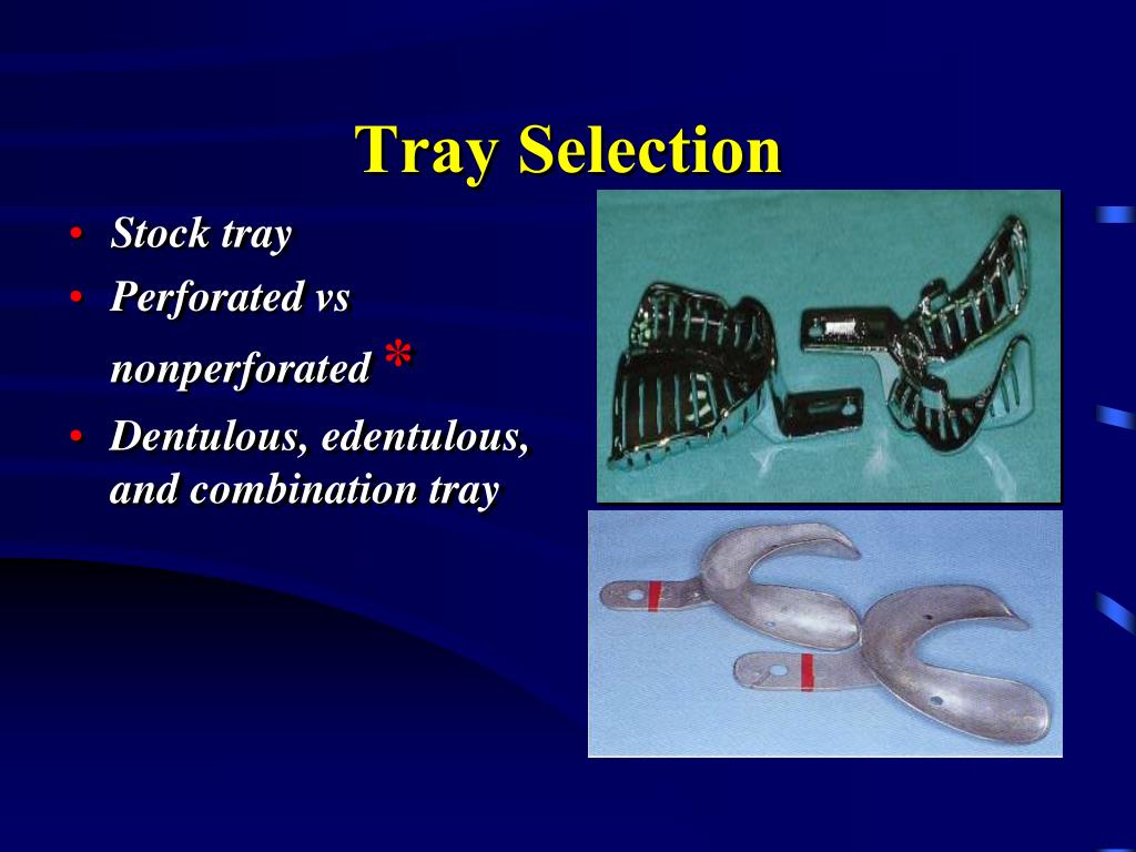 a maxillary alginate impression routinely requires a maxillary alginate impression routinely requires