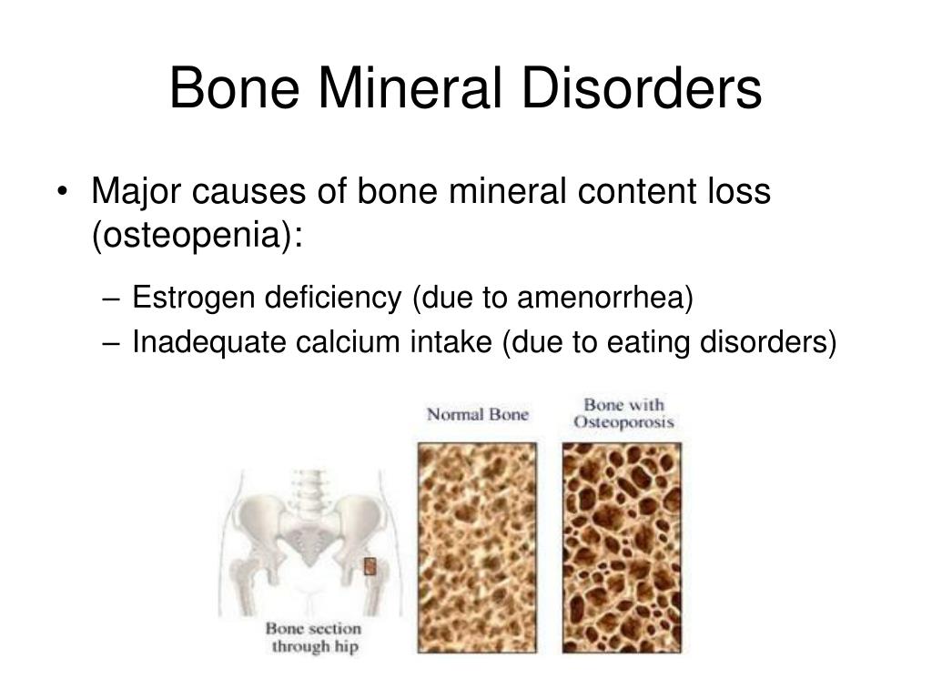 Bone mineral