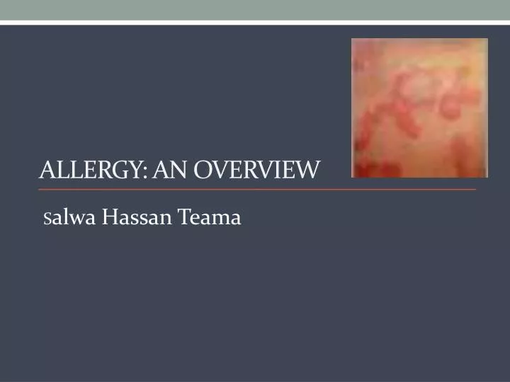 allergy an overview n.