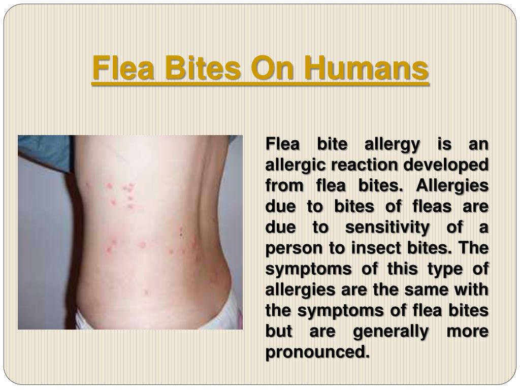 PPT Flea Bites On Humans PowerPoint Presentation, free download ID