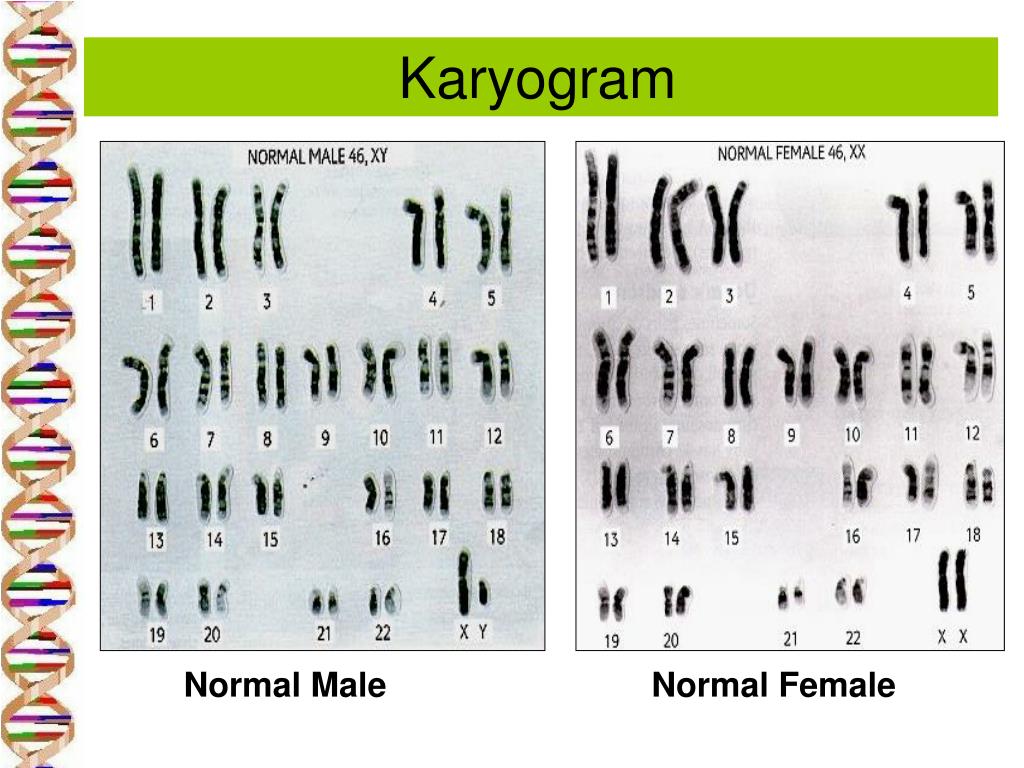 Ppt Karyogram And Karyotype Powerpoint Presentation Id 151187