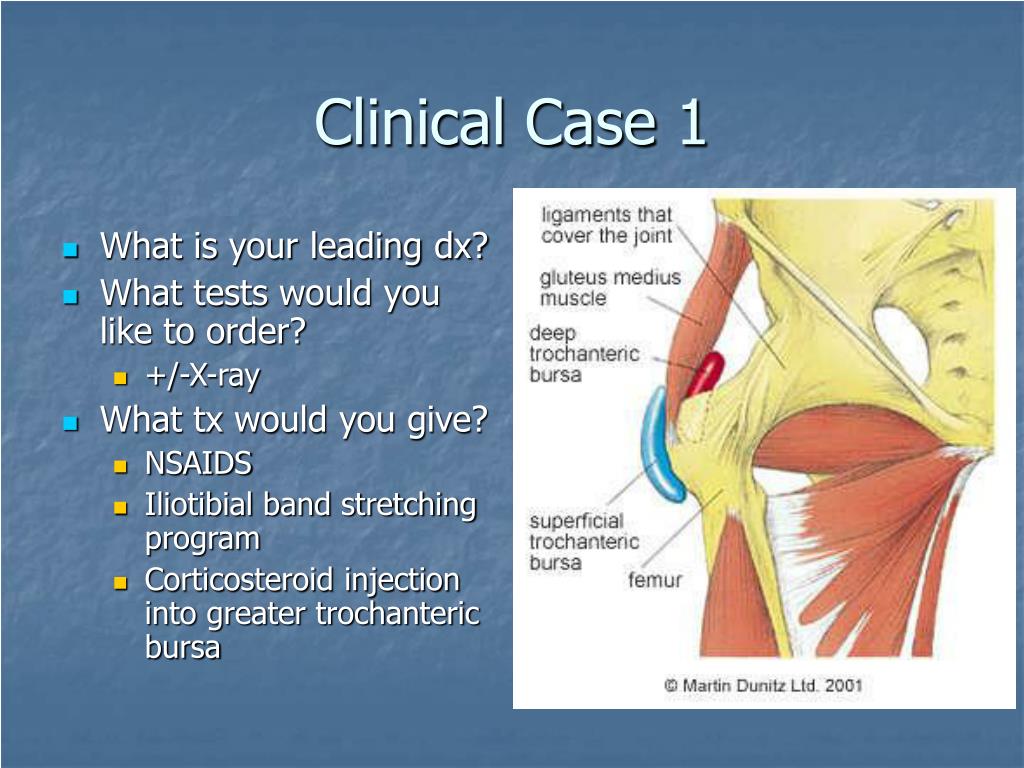 case presentation hip