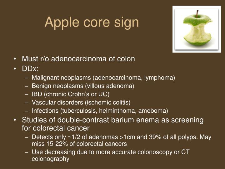 PPT Seeing the signs of Radiology PowerPoint Presentation ID158707