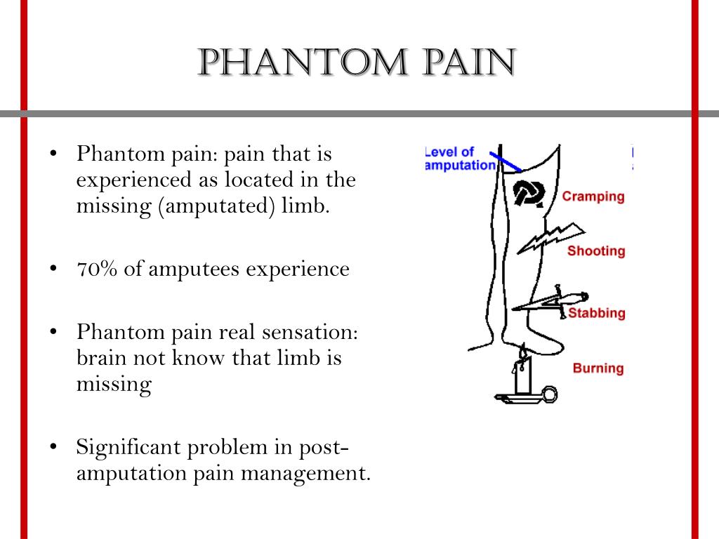 the meaning of phantom pain