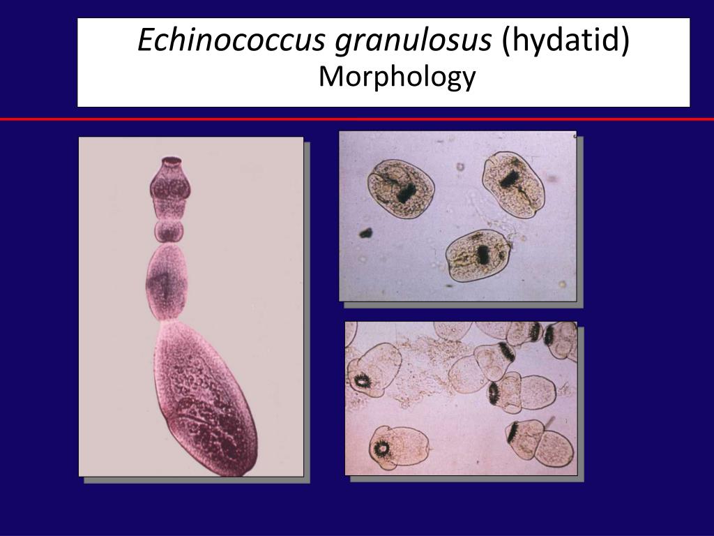 Эхинококк. Протосколексы Echinococcus granulosus. Echinococcus granulosus – эхинококк alveococcus multilocularis – альвеококк.