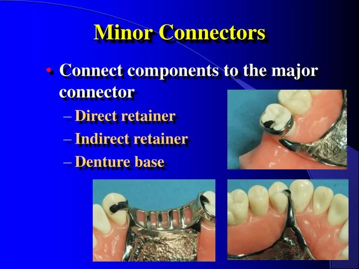 minor connectors n.