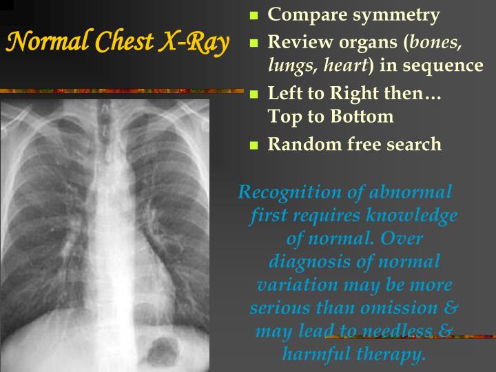 Ppt Chest X Ray Review Powerpoint Presentation Free Download Id 172434