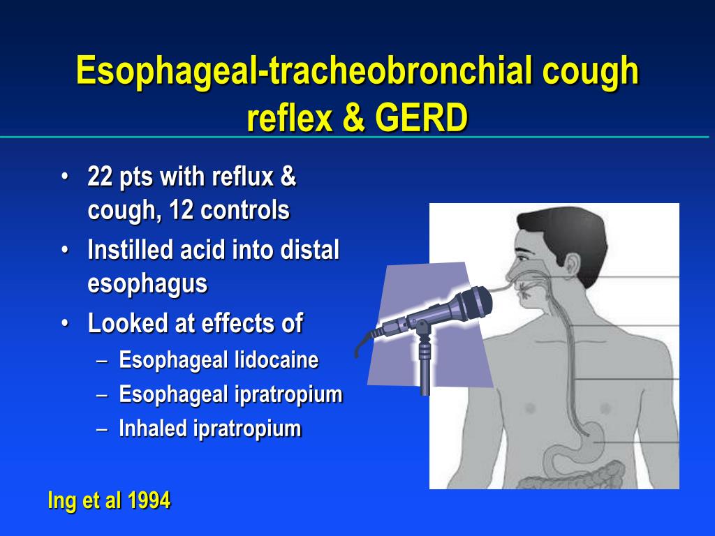 PPT - Chronic Cough PowerPoint Presentation - ID:172723