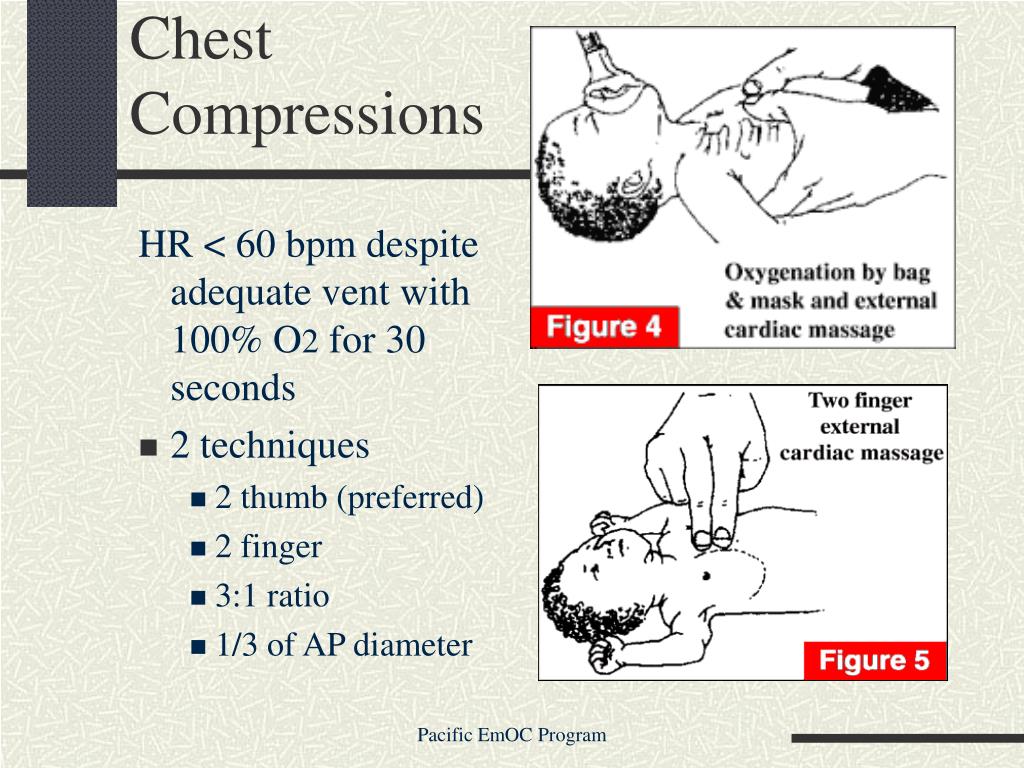 chest compression fraction acls chest compression fraction acls