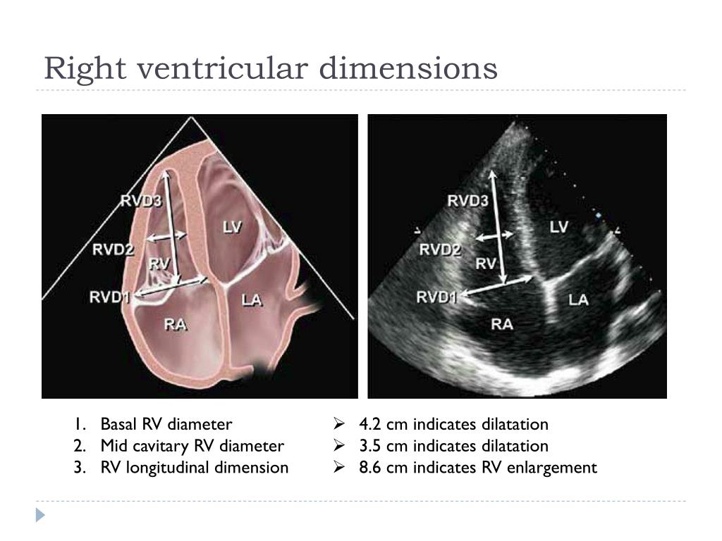 PPT - Echocardiographic Assessment of the Right Heart in Adults PowerPoint Presentation - ID:178154