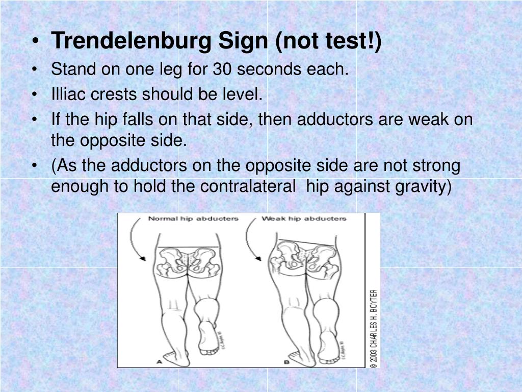 PPT - Common OSCES for Muskuloskeletal system for finals PowerPoint ...