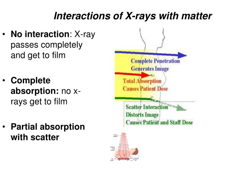 x ray interaction with matter essay The center for x-ray optics x-ray interactions with matter calculator. x ray interaction with matter essay The center for x-ray optics x-ray interactions with matter calculator.