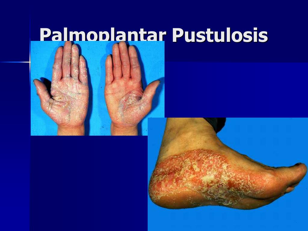 PPT - Andrews’ Diseases of the Skin-Chapter 10-pg 239-253 & Chapter 11 ...