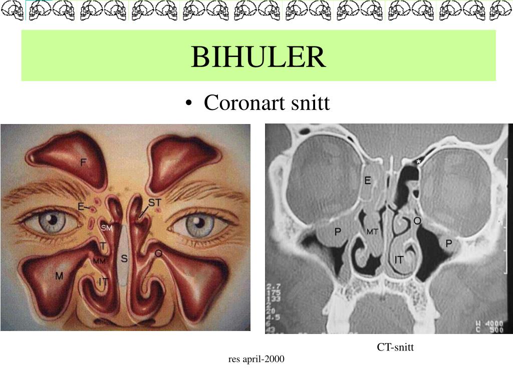PPT CRANIUM PowerPoint Presentation Free Download ID 196212